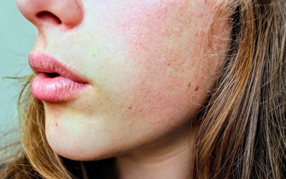 Credit: Pexels | Jenna Hamra - Close-up facial skin texture